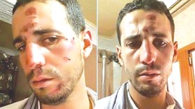 نجل رئيس دائرة في البيض متهم بالاعتداء على مواطن بصاعق كهربائي
