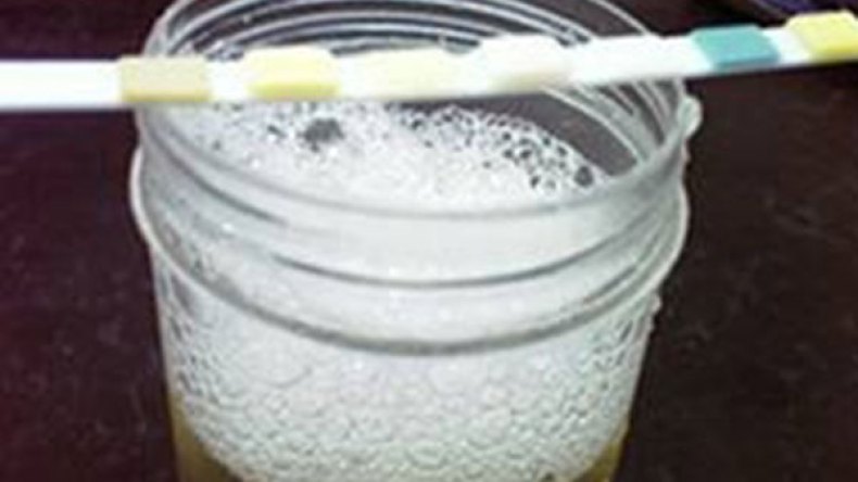 ماء جافيل.. قمح وشعير لاختبارات الحمل في المداشر!