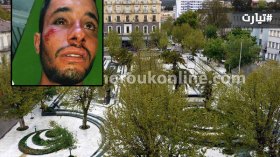 طبيب أسنان يبرح زبونا ضربا بتيارت لأنه رفض التسديد