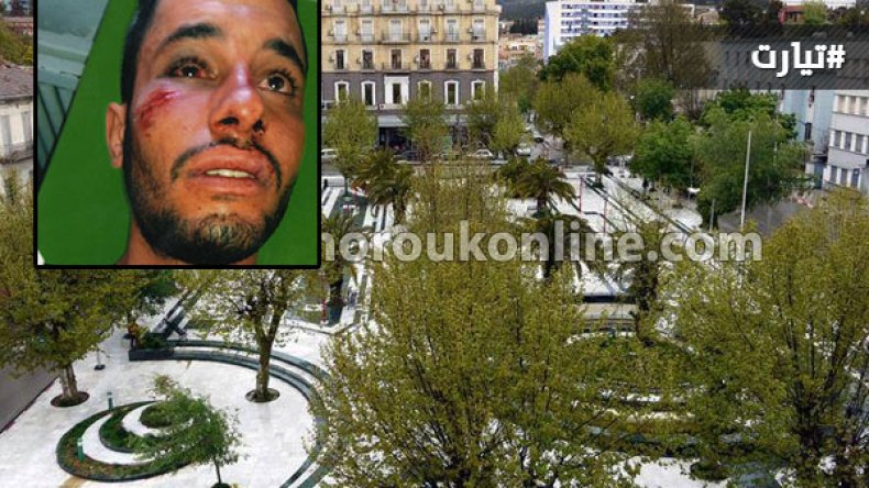 طبيب أسنان يبرح زبونا ضربا بتيارت لأنه رفض التسديد