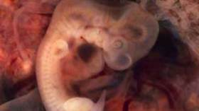 جنين هجين من بويضة بقرة والحامض النووي البشري