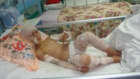 التلميذة وئام مزقتها الكلاب وتناشد معلمتها الرحمة