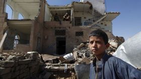 موت طفل يمني كل عشر دقائق بسبب سوء التغذية والأمراض