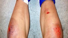 حملة عالمية ضد الملاعب المعشوشبة اصطناعيا