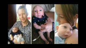 كيف تحدّى طفل بنصف جمجمة الحياة… وعاش؟