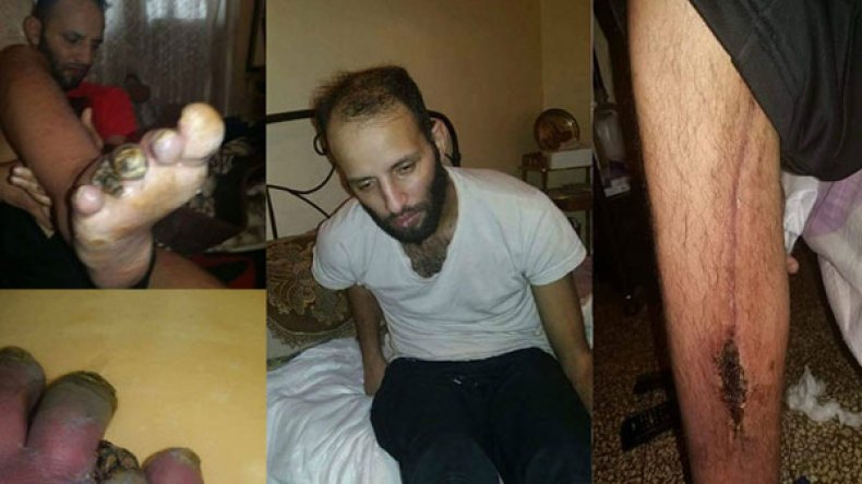 الشارع الباتني يتحرك لجمع نصف مليار وإعادة البسمة للحارس عبد السلام