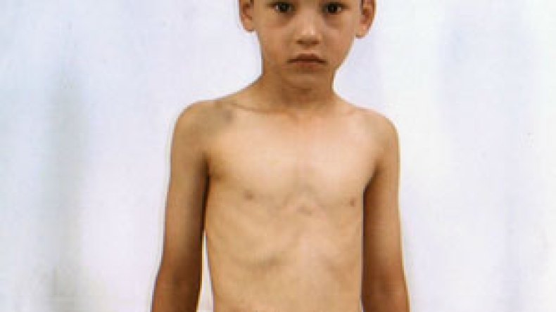 عبد الرحمن يموت في صمت ويعيش ببطن مفتوحة منذ سنتين