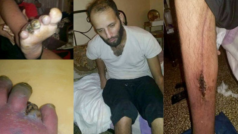 الحارس عبد السلام يدخل في غيبوبة والجميع يطالب بتعجيل نقله إلى الخارج