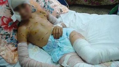 340.000 enfants victimes d’accidents domestiques en 2010