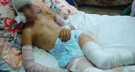 340.000 enfants victimes d’accidents domestiques en 2010