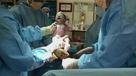 أطباء يتاجرون بالعمليات القيصرية وحوامل يطلبنها تفاديا لآلام المخاض!