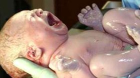 الولادة ساعة الإفطار ممنوعة!