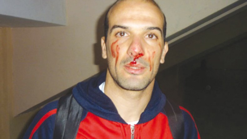 أشيو: سأعتزل كرة القدم إذا لم يعاقب الصعلوك الذي اعتدى عليّ