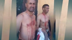 عاطلون يمزقون أجسادهم بالسكاكين في الأغواط