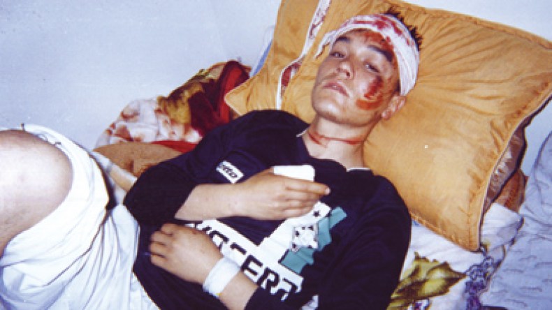 عصابة تختطف شابا وتقطع لحمه بكماشة