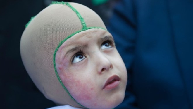الطفل الفلسطيني “الدوابشة” يصل إلى مقر ريال مدريد