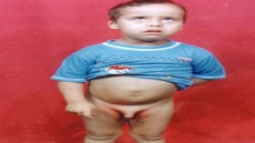 الطفل‭ ‬‮”‬أحمد‮”‬‭ ‬يفقد‭ ‬ذكورته‭ ‬عقب‭ ‬ختان‭ ‬فاشل‭ ‬بالشلف‭!‬