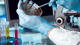 باحث جزائري ينجح في إيجاد دواء للسيدا وأمراض مستعصية أخرى