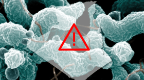 وزارة الصحة: كفوا عن مغالطة الناس… فلا وجود للتيفوئيد