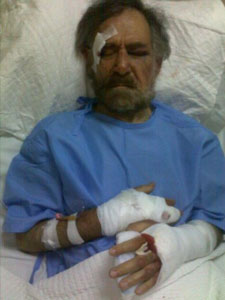 Les sbires d'Assad écrasent les mains d'un caricaturiste syrien