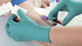 لا تحاليل طبية في المستشفيات والمخابر الخاصة دون بطاقة هوية