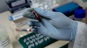 تحاليل تكشف مدة عيش الإنسان