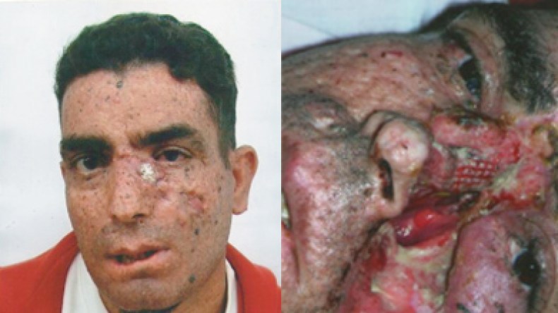 دار الثقافة بخنشلة تتكفل بعلاج عندليب الأغنية الشاوية