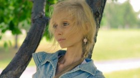 أمراض ووفيات جرّاء اتباع أقسى أنواع الحميات!