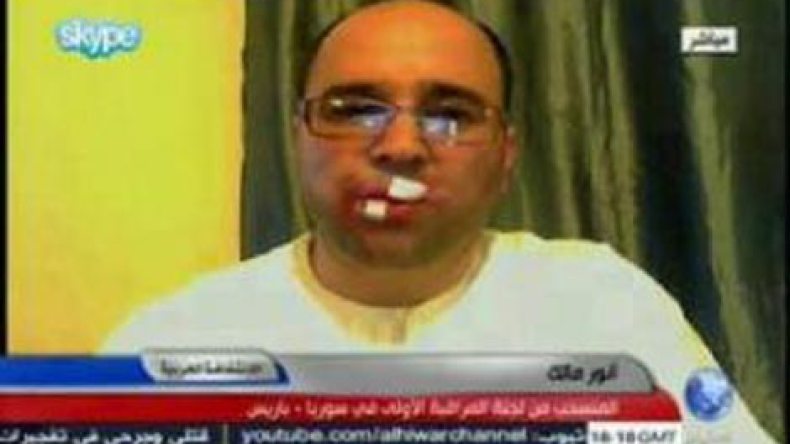 أنور مالك يتعرض لاعتداء جسدي في تولوز الفرنسية