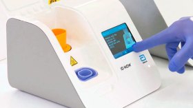 الجزائر تباشر قريبا إنتاج مليون وحدة للكشف السريع عن كورونا