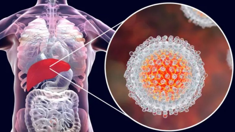 التهاب الكبد الفيروسي يضرب عدّة مناطق شرق الوطن