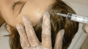 التقصف والتساقط وآثار المكيفات الهوائية