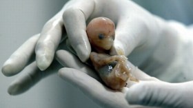 طبيبة.. قابلة ومنظفة يُدرن شبكة لإجهاض الأمهات العازبات ببشار