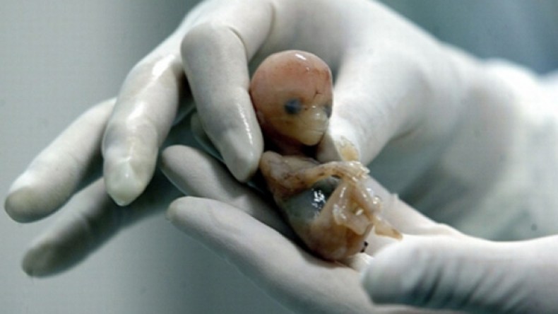 طبيبة.. قابلة ومنظفة يُدرن شبكة لإجهاض الأمهات العازبات ببشار