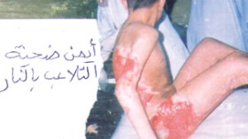 3 وحوش ادمية تداولوا على تعذيب طفل وحرقه بالنار