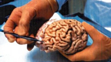 Les hypertendus ont recours à la scarification : 100 mille algériens atteints annuellement de sénilité