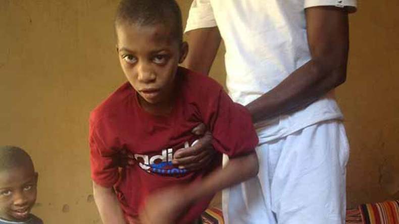 مرض غريب يصيب طفلين بتمنراست ويفقدهما الحركة كليا