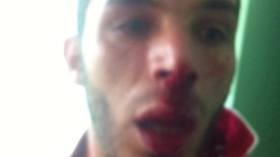 شغب في مباراة اتحادي حجوط وسيدي بلعباس