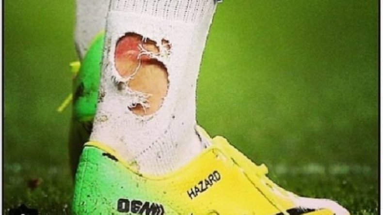 أنصار منتخب بلجيكا ساخطون على المدافع الكاميروني “شادجو”