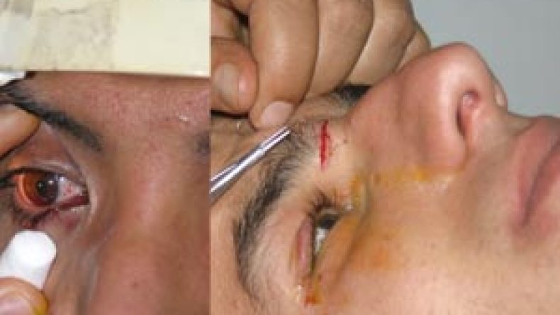 إرهاب المفرقعات يخلف 13 قتيلا وعشرات الجرحى