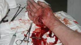 عاهات مستديمة، ندبات في الوجه وإصابات بـ”العمى”