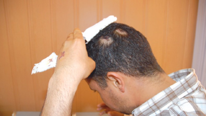 شرطي سكران يزرع الرعب بالعاصمة ويطلق النار عشوائيا