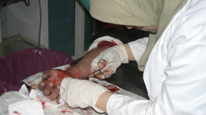 حالات عمى وتشوّهات وحروق وسط الأطفال