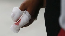 شاب يبتر أصبعَي والده بسكين في وهران