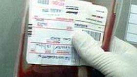 الجزائر تخصص 3,5 مليار دج لمواجهة مرض الالتهاب الكبدي