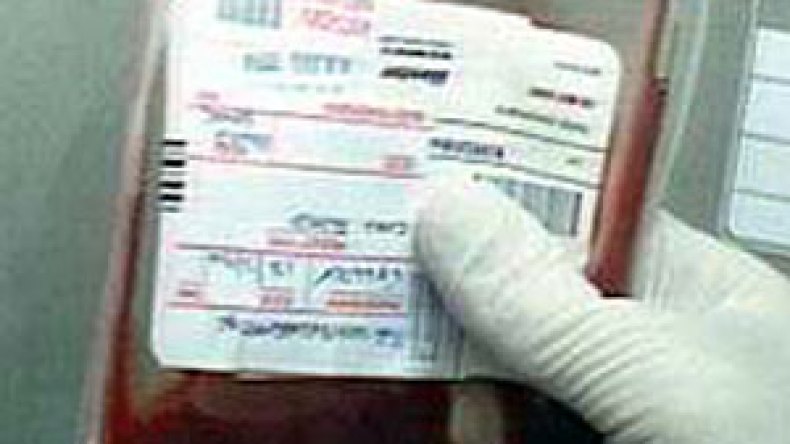 الجزائر تخصص 3,5 مليار دج لمواجهة مرض الالتهاب الكبدي