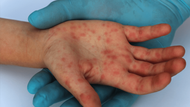 هزمكم البوحمرون!