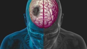 40 ألف إصابة بالأمراض الدماغية سنويا