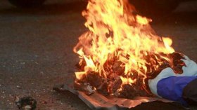 عون أمن يحرق جاره بالبنزين بسبب خلاف بينهما في البليدة