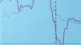 EU says no recovery until mid-2010
